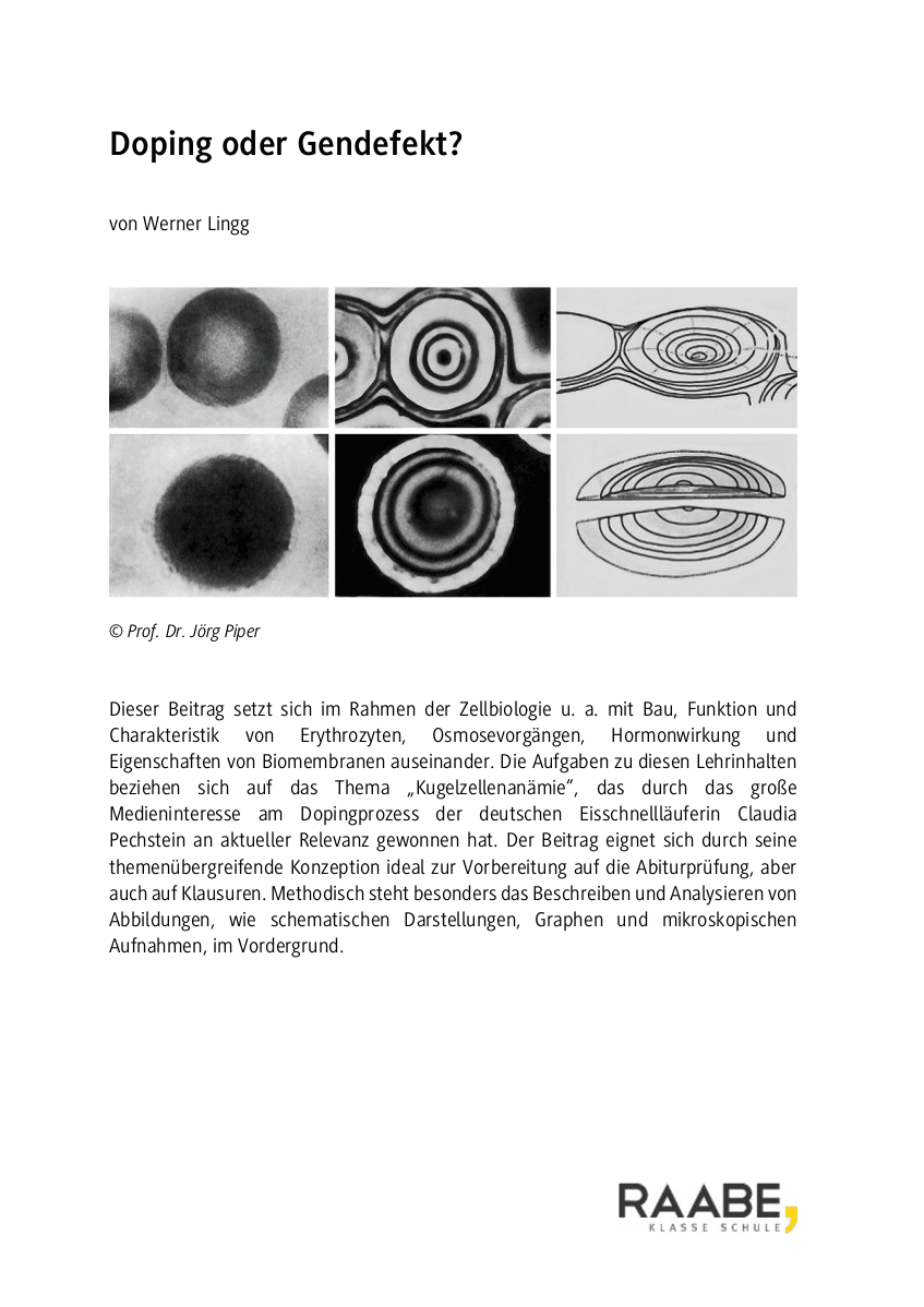 Doping oder Gendefekt?