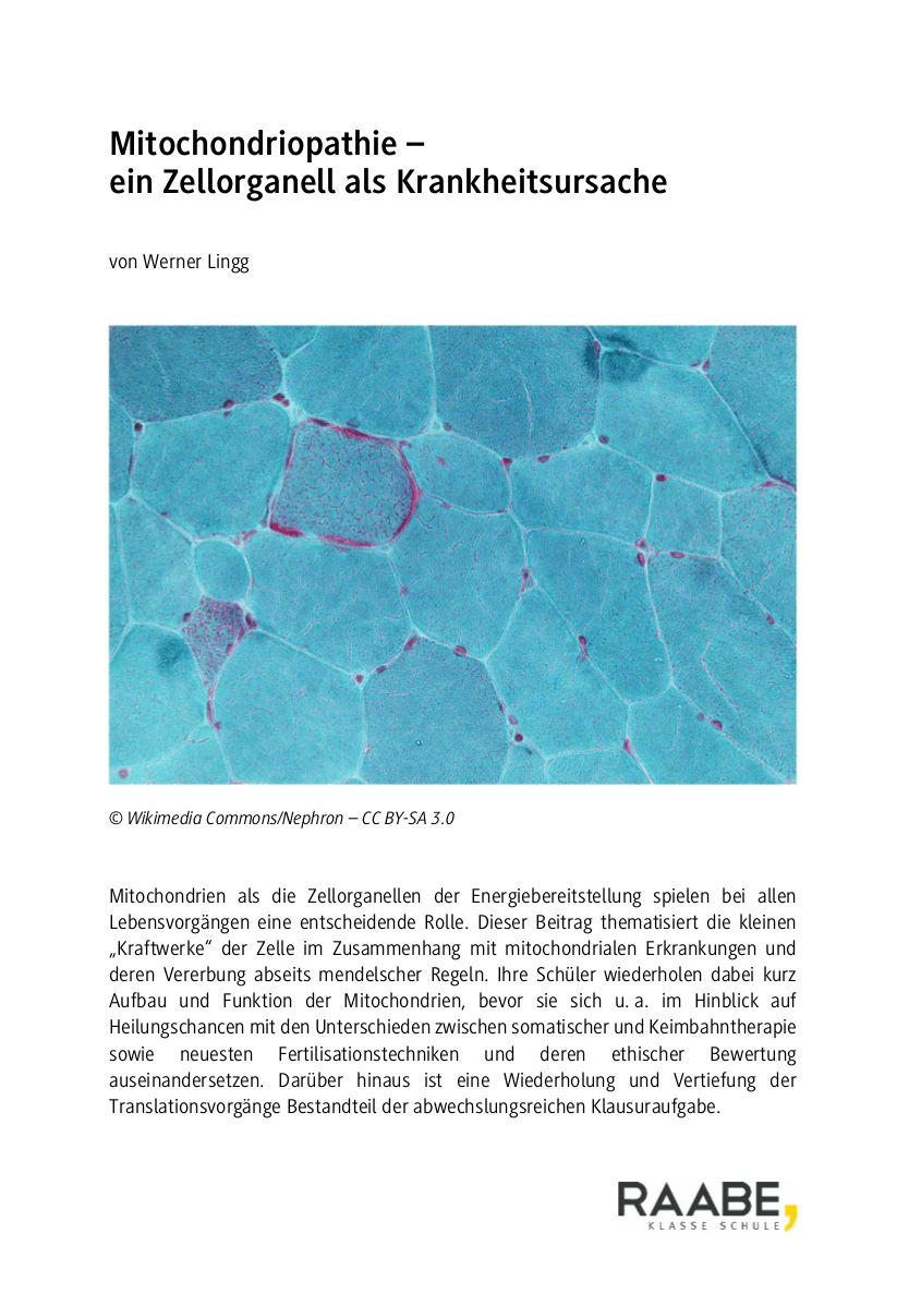 Mitochondriopathie