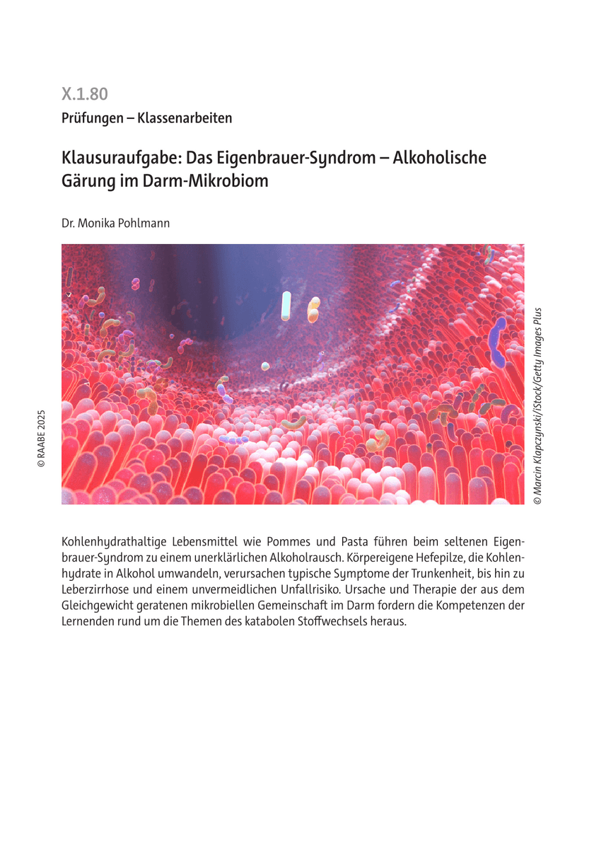 Klausuraufgabe: Das Eigenbrauer-Syndrom