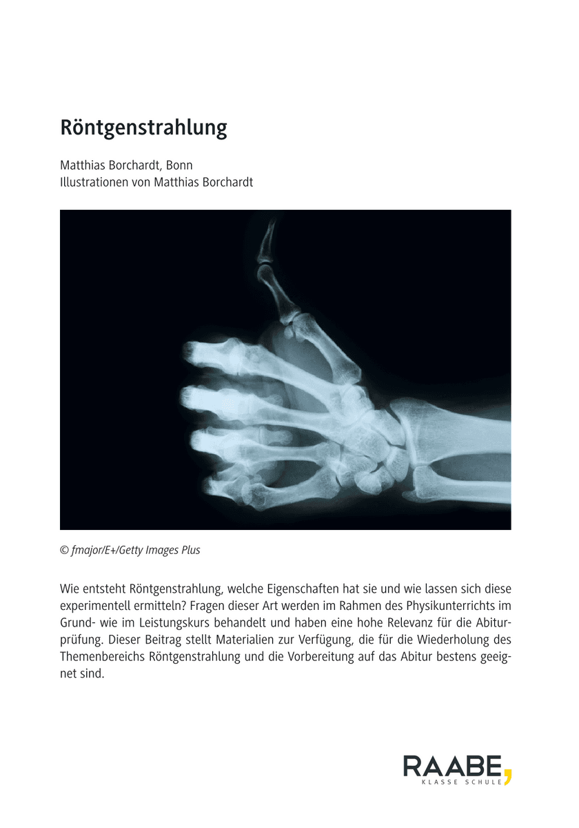 Röntgenstrahlung