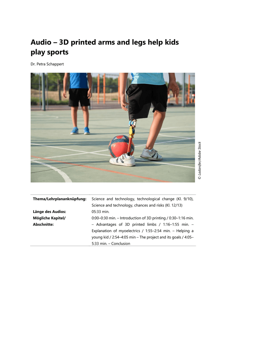 Audio – 3D printed arms and legs help kids play sports