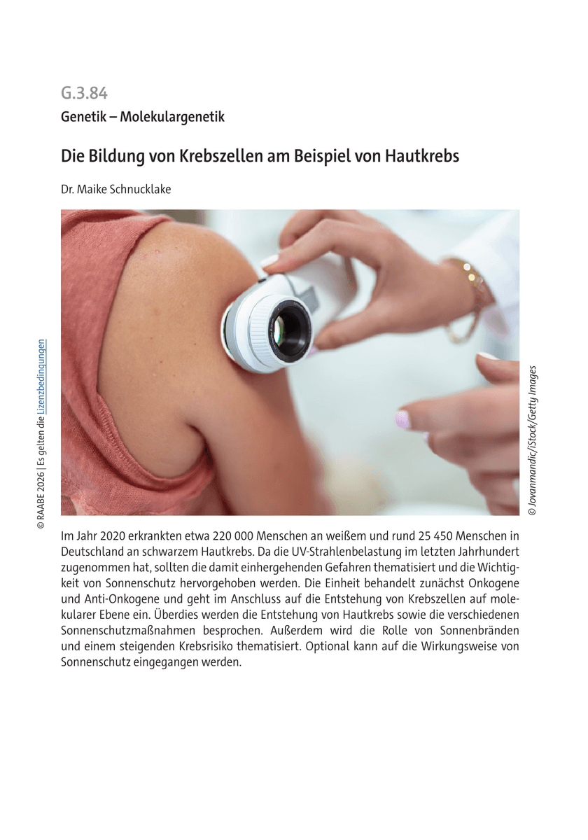 Die Bildung von Krebszellen am Beispiel von Hautkrebs Die Bildung von Krebszellen am Beispiel von Hautkrebs